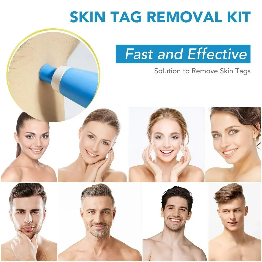 2-IN-1 Auto Skin Tag Removal Tool Kit Painless Skin Label Mole Acne Wart Removal Pen with Cleansing Swabs Facial Skin Care Tool