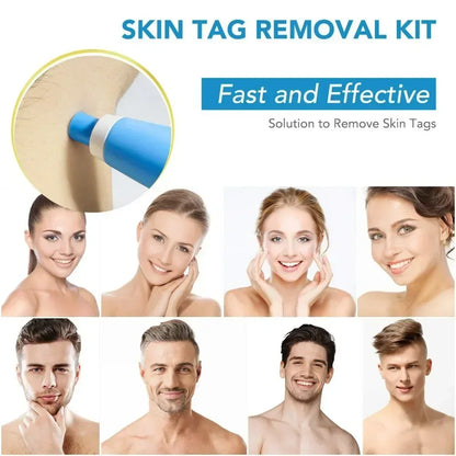 2-IN-1 Auto Skin Tag Removal Tool Kit Painless Skin Label Mole Acne Wart Removal Pen with Cleansing Swabs Facial Skin Care Tool