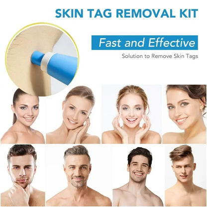 2-IN-1 Auto Skin Tag Removal Tool Kit Painless Skin Label Mole Acne Wart Removal Pen with Cleansing Swabs Facial Skin Care Tool